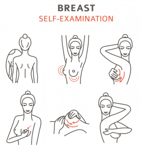 Breast self examination - breast cancer detection 